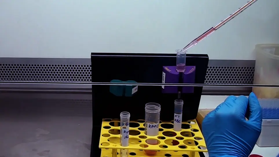 <em>In Vitro</em> Assay of <em>Plasmodium</em>-Infected Red Blood Cell Killing by Cytotoxic Lymphocytes