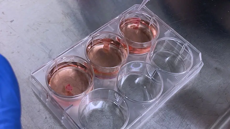 Extraction, Labeling, and Purification of Lineage-Specific Cells from Human Antral Follicles