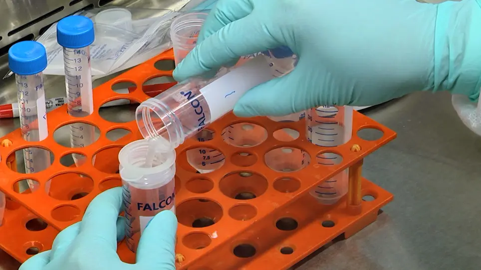 Intra-Peritoneal Transplantation for Generating Acute Myeloid Leukemia in Mice
