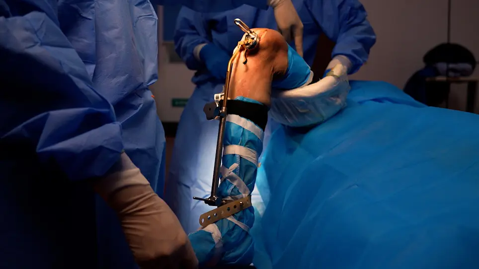 <em>In Vitro</em> Application of a Wireless Sensor in Flexion-Extension Gap Balance of Unicompartmental Knee Arthroplasty