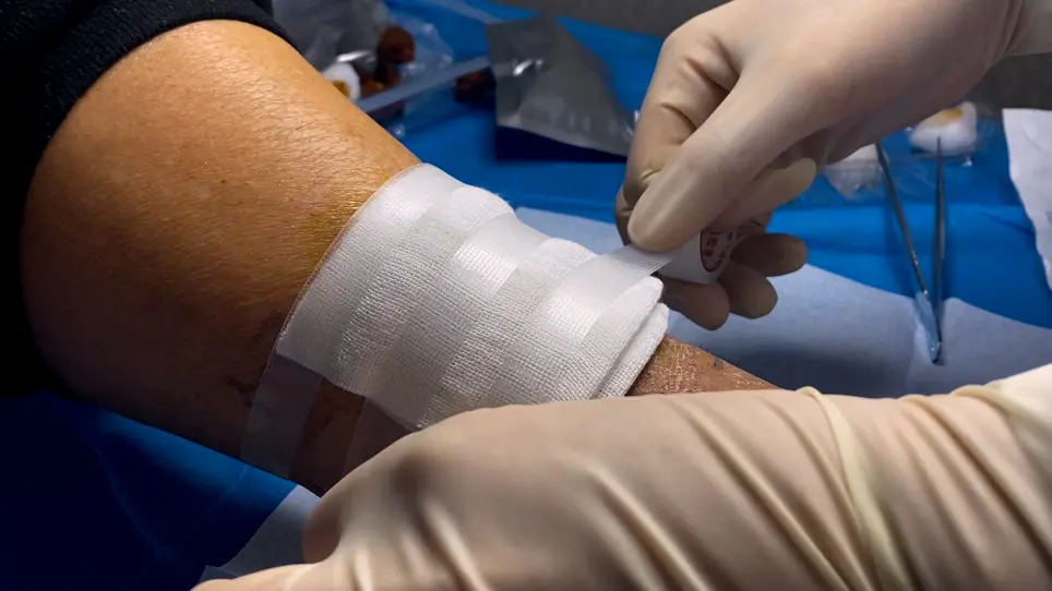 Prospective, Randomized, and Controlled Study of a Human Umbilical Cord Mesenchymal Stem Cell Injection for Treating Diabetic Foot Ulcers