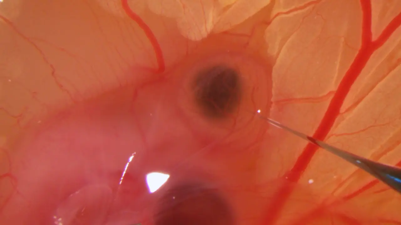 Using the Chick Embryo Brain as a Model for <em>In Vivo</em> and <em>Ex Vivo</em> Analyses of Human Glioblastoma Cell Behavior