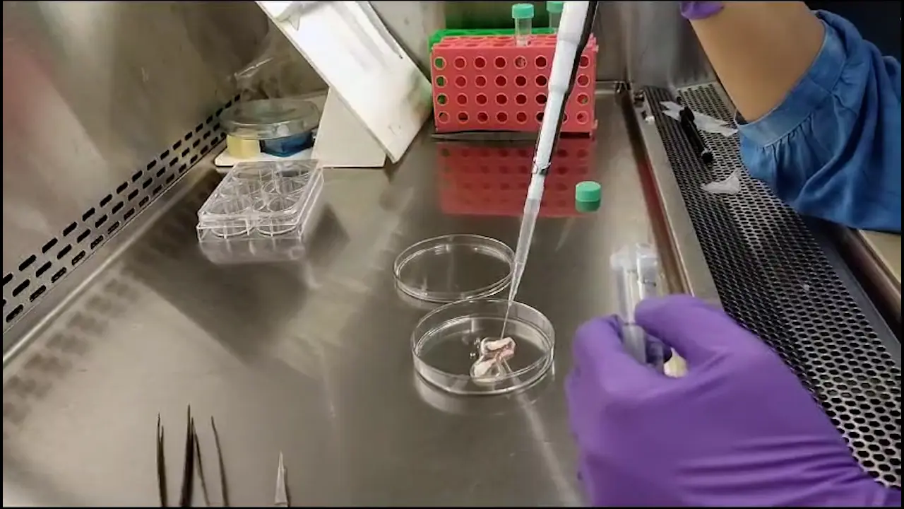 Primary Culture of Dental Pulp Stem Cells