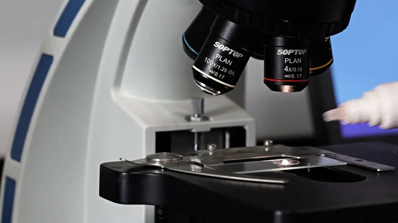 Evaluation of Lipid Droplet Size and Fusion in Bovine Hepatic Cells