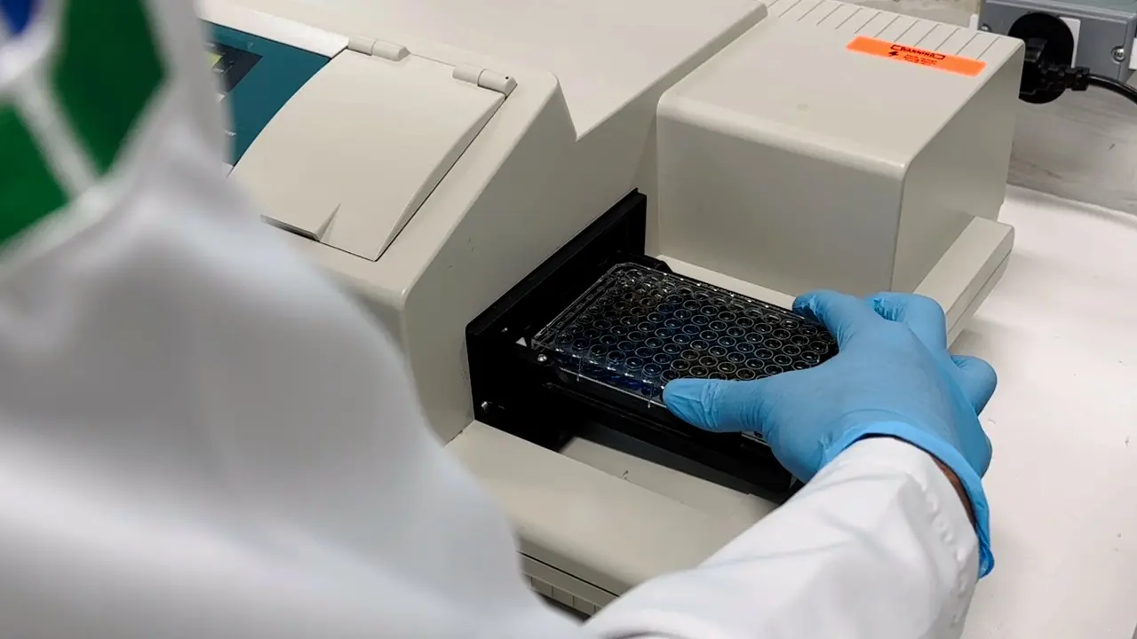 RGBradford: Protein Quantitation with a Smartphone Camera