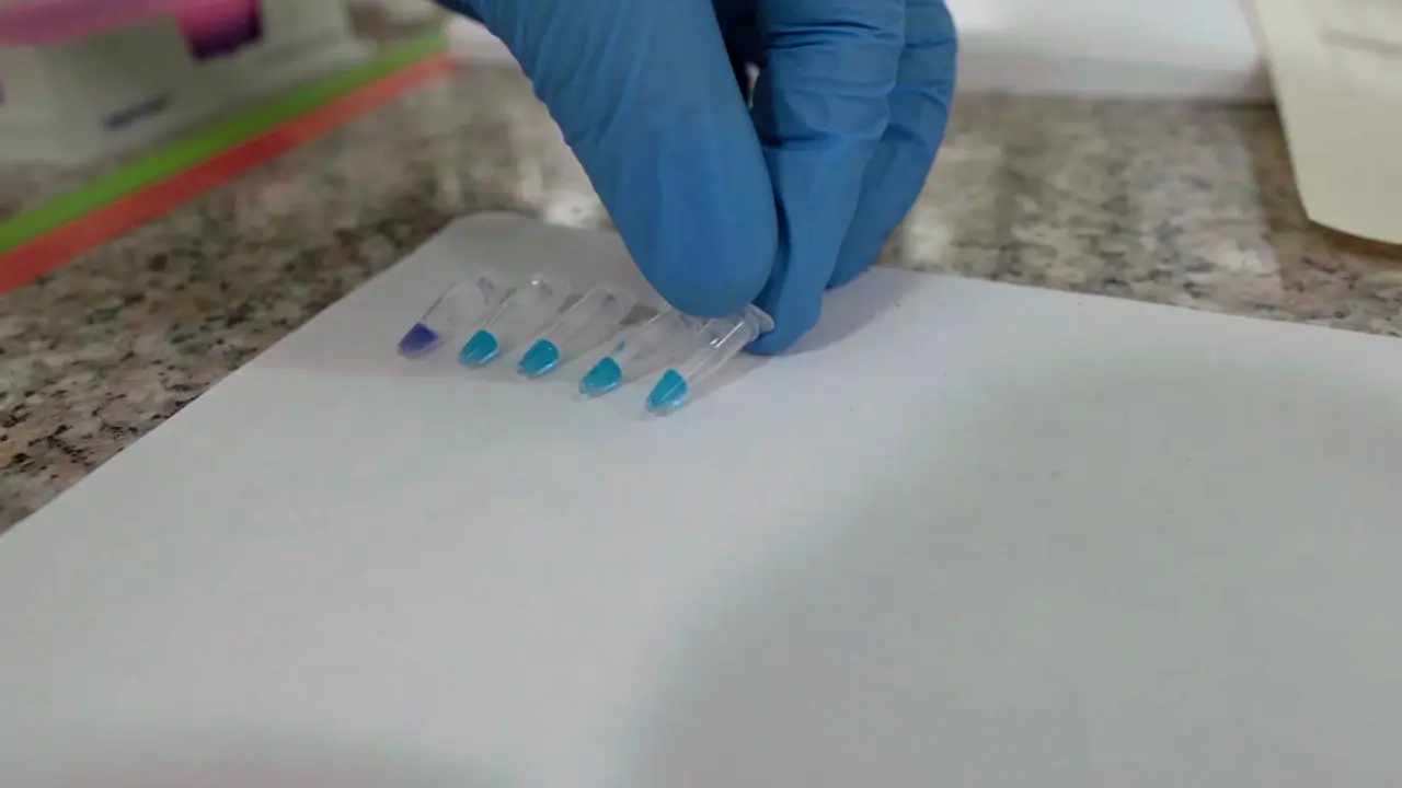 Detecting SARS-CoV-2 Virus by Reverse Transcription-Loop-Mediated Isothermal Amplification