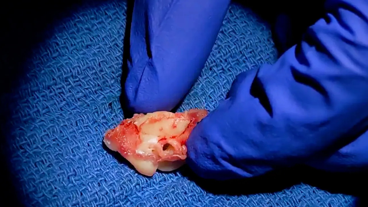 Guinea Pig Round Window Membrane Explantation for Ex Vivo Studies