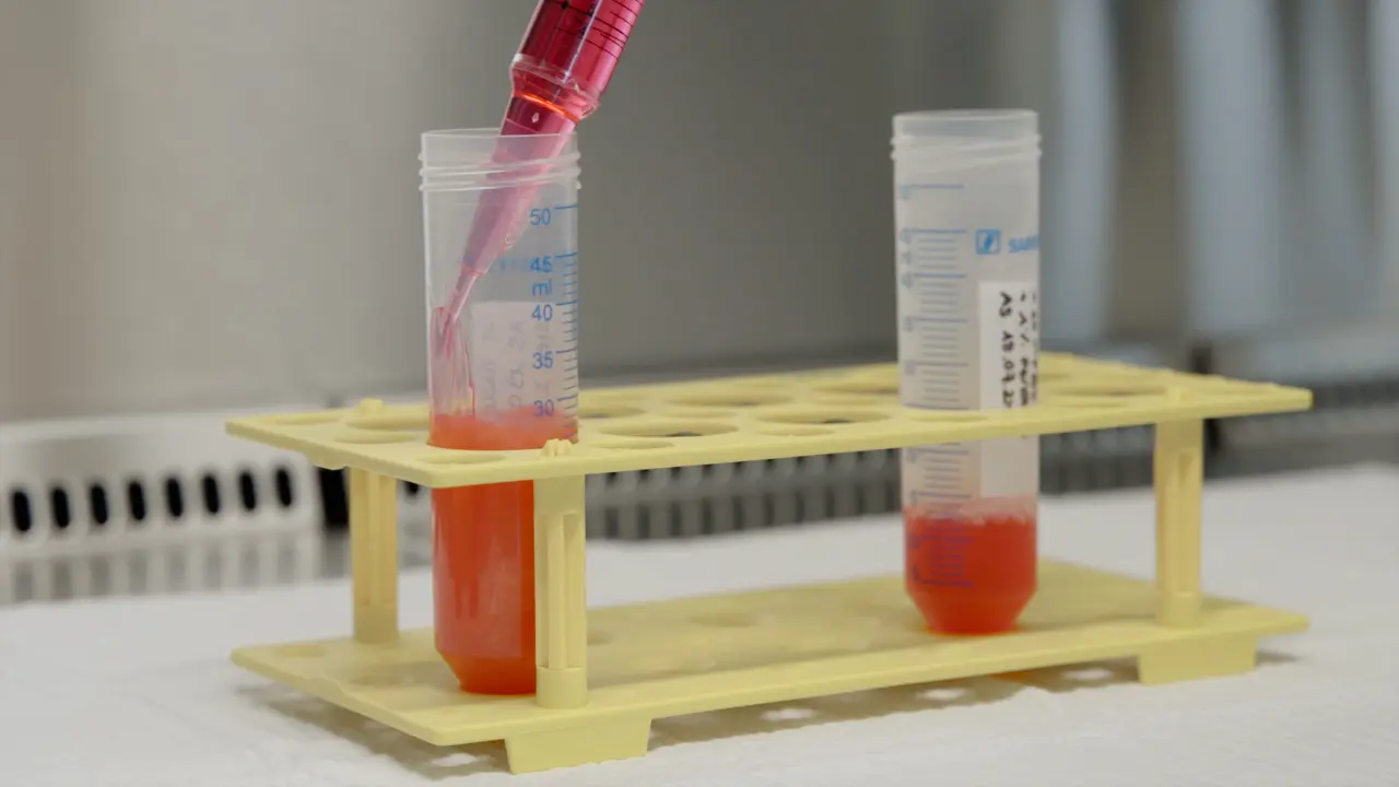 The Combination of Mechanically Isolated Stromal Vascular Fraction and Fibrin Hydrogel: A Processing Protocol