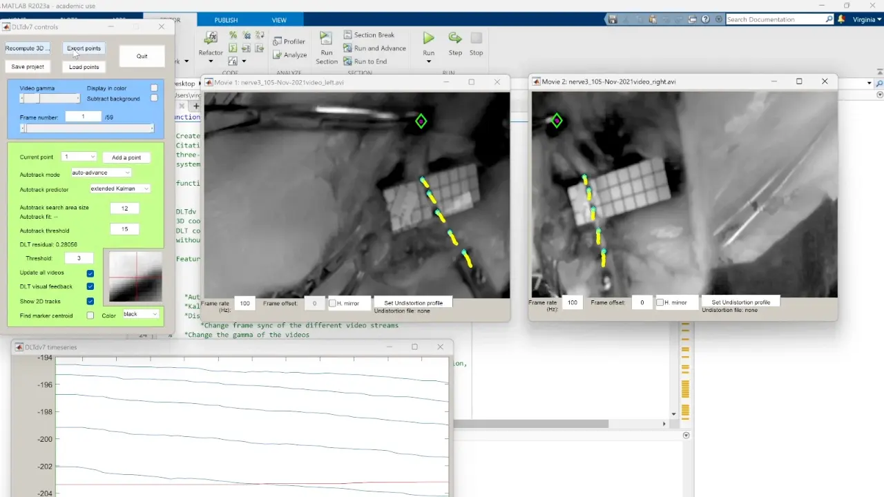 Direct Linear Transformation for the Measurement of <em>In-Situ</em> Peripheral Nerve Strain During Stretching