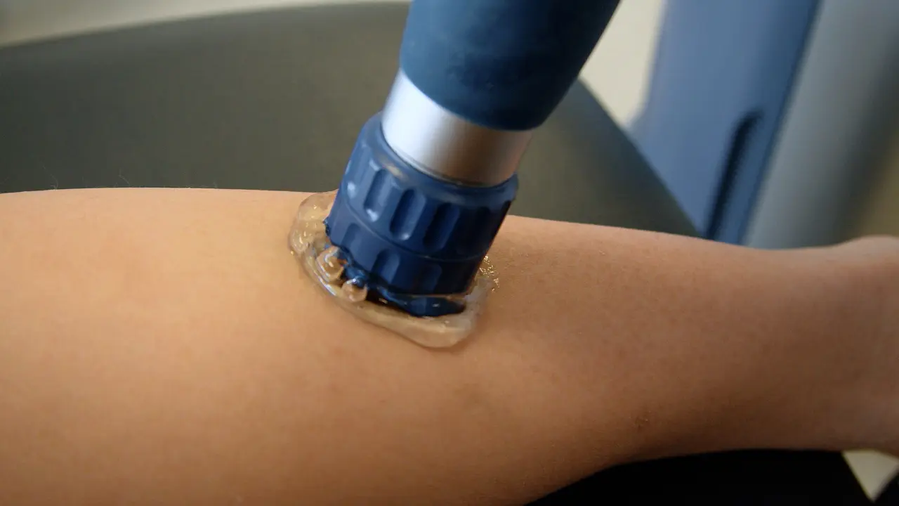 A Treatment Protocol for Achilles Tendinopathy with Extracorporeal Shockwave Therapy