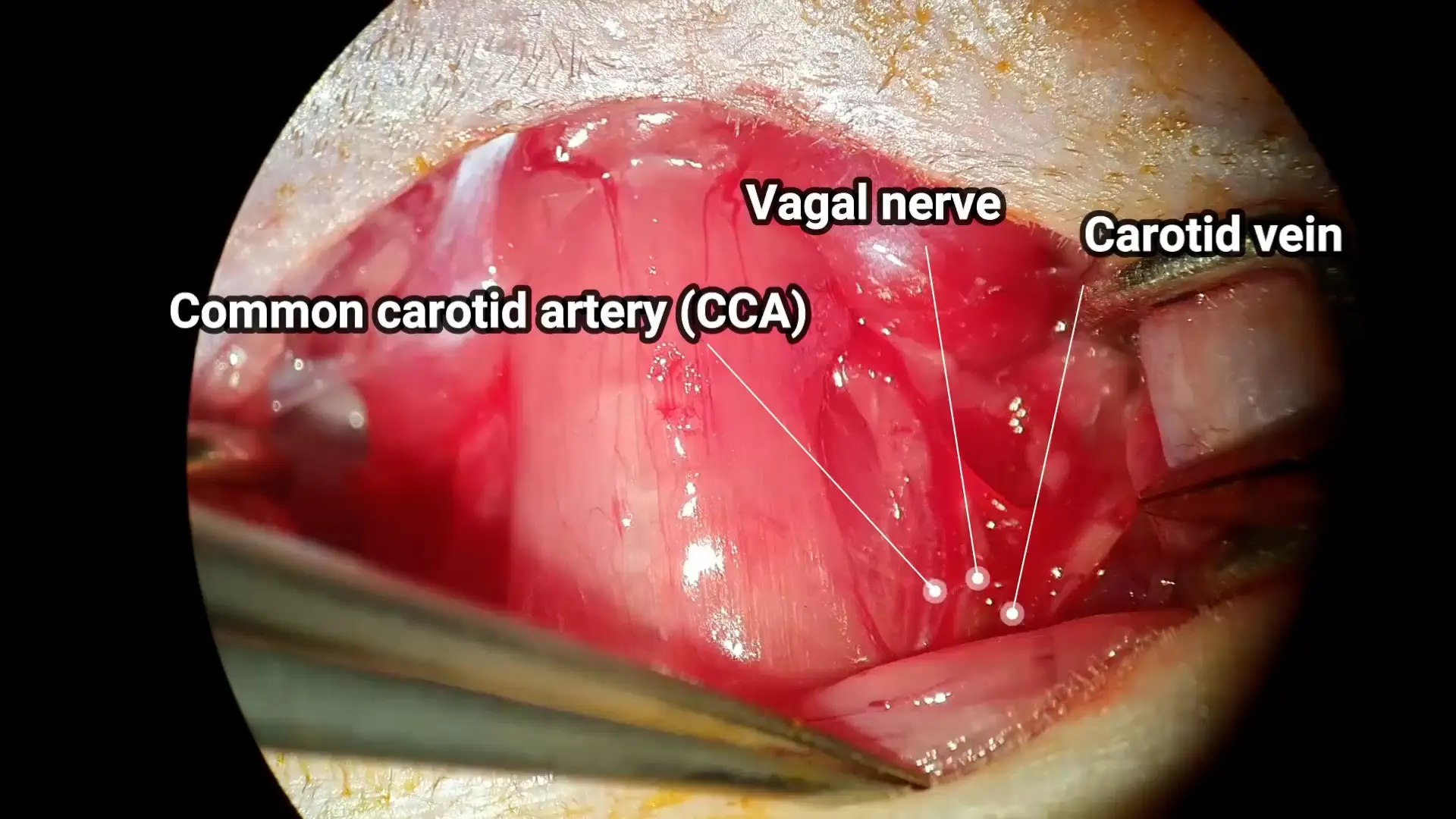 Optimization of the Longa Middle Cerebral Artery Occlusion Method for Complete Reperfusion
