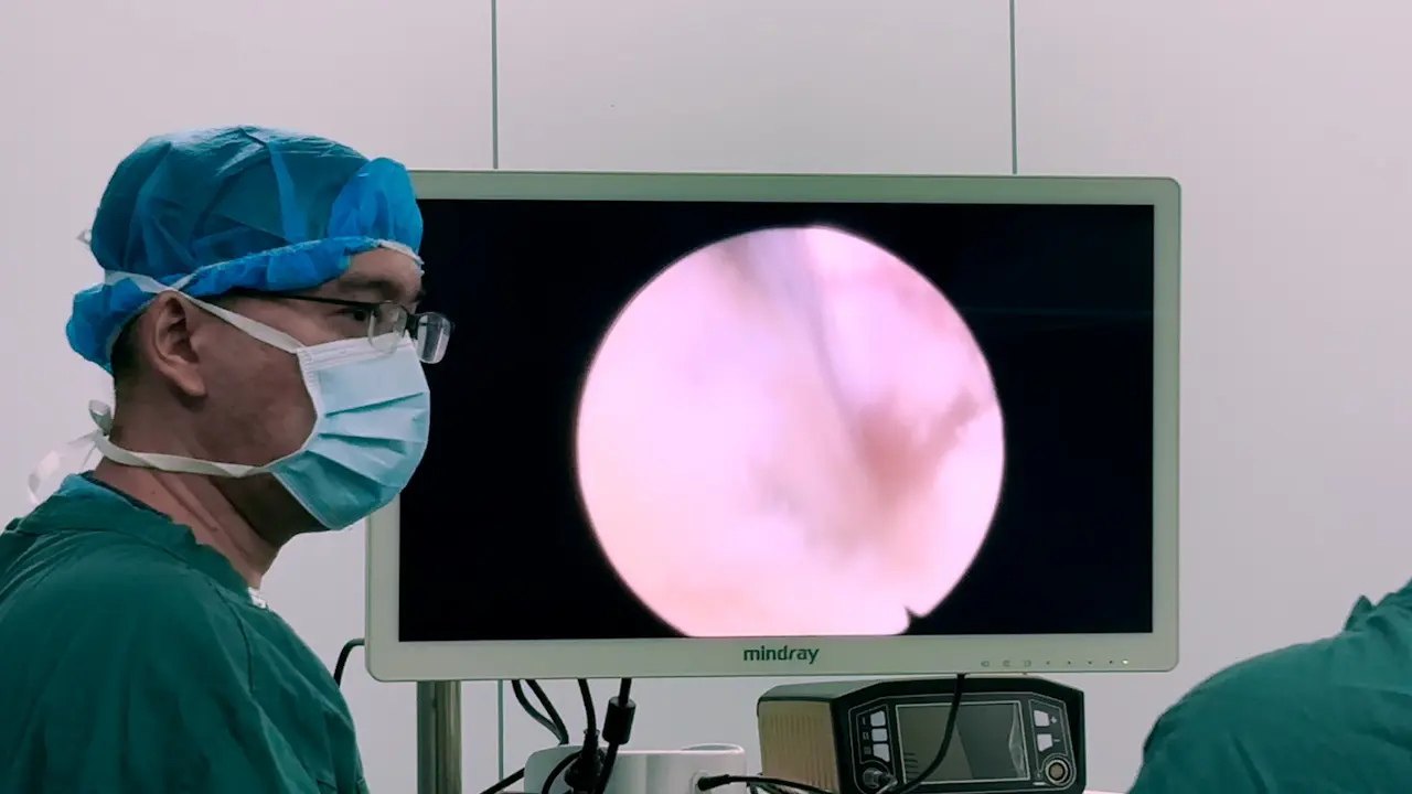 A Retrospective Study on Endoscopic Surgery for the Treatment of Paravertebral Abscess in Spinal Tuberculosis Patients