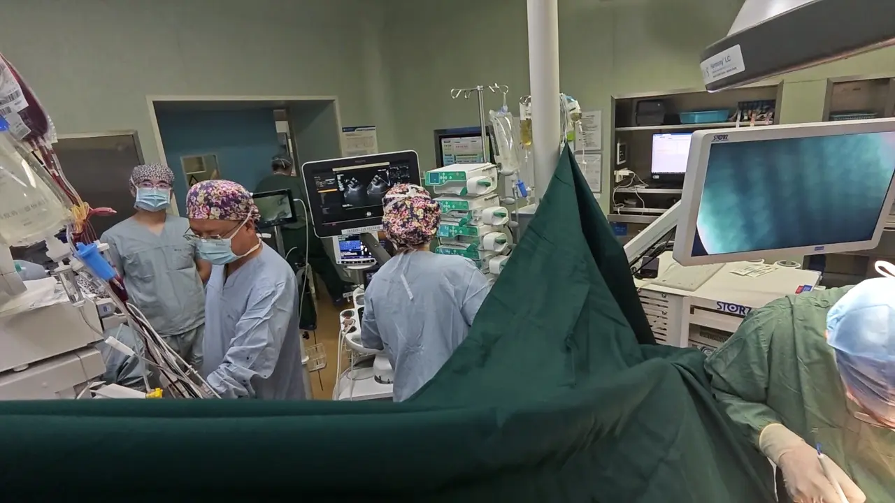 Donor Posterior Atrial Flap Rotation for Left Atrial Cuff Reconstruction in Lung Transplantation