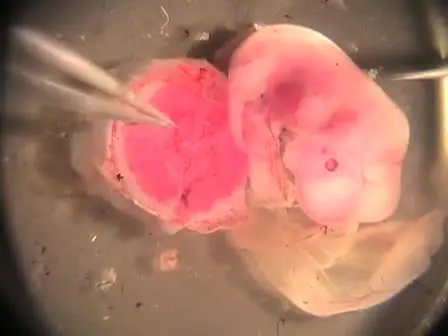 Isolation and Analysis of Hematopoietic Stem Cells from the Placenta
