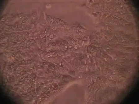 Trypsinizing and Subculturing Mammalian Cells