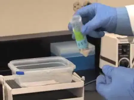 Immunoblot Analysis