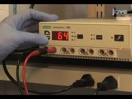 Screening for Amyloid Aggregation by Semi-Denaturing Detergent-Agarose Gel Electrophoresis