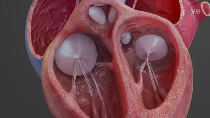 Heart Valves
