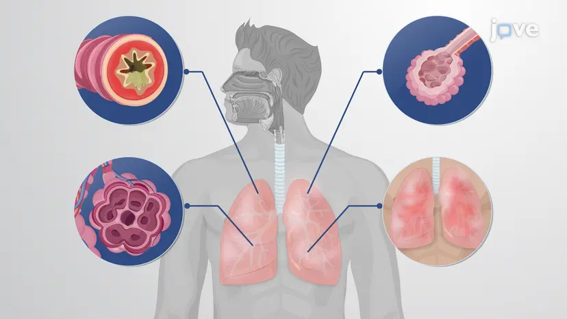 COPD 的发病机制和临床特征