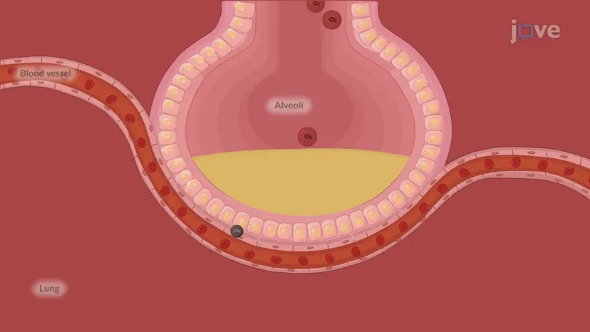 Acute Respiratory Failure-I