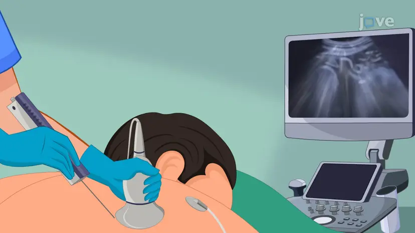Pneumothorax-I