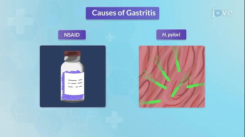 Gastritis-II: Pathophysiologie