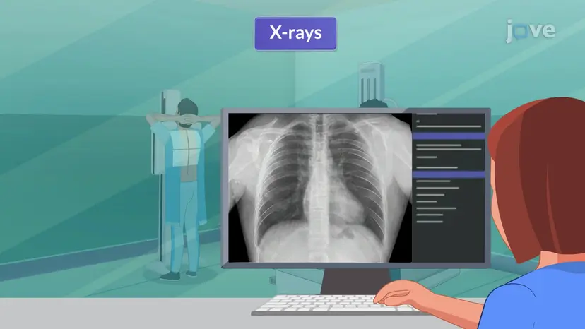 심혈관계계 III에 대한 영상 연구: X-ray