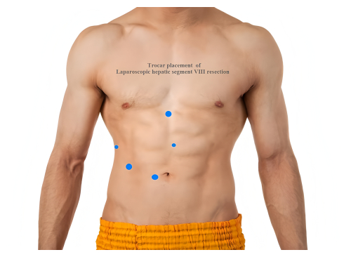 figure-results-1970